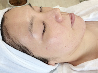 facial_05